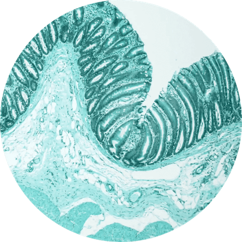 Microscopic view of tissue with a focus on cellular structure.