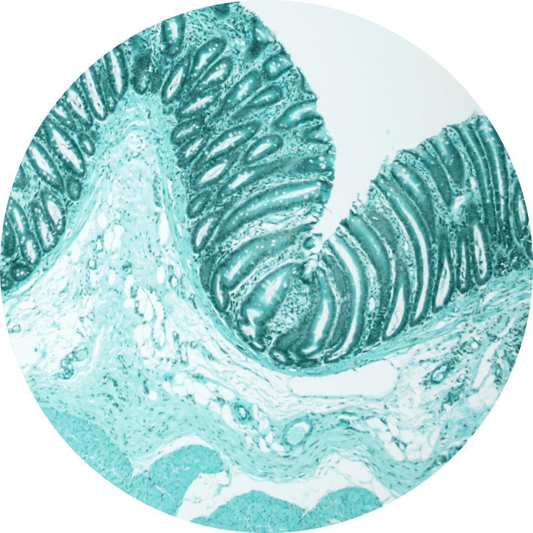 Armra - HISTOLOGY